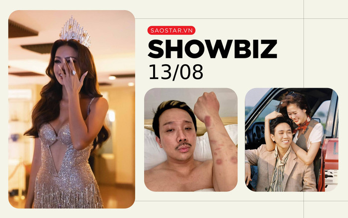 Showbiz 13/8: Hoa hậu Ngọc Châu báo tin buồn, Trấn Thành bị thương tích khắp cánh tay Ảnh 2