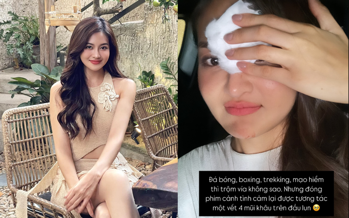 Thùy Anh dù tỏ ra lạc quan nhưng vẫn không giấu khỏi sự lo lắng vì vết thương. Ảnh: FBNV