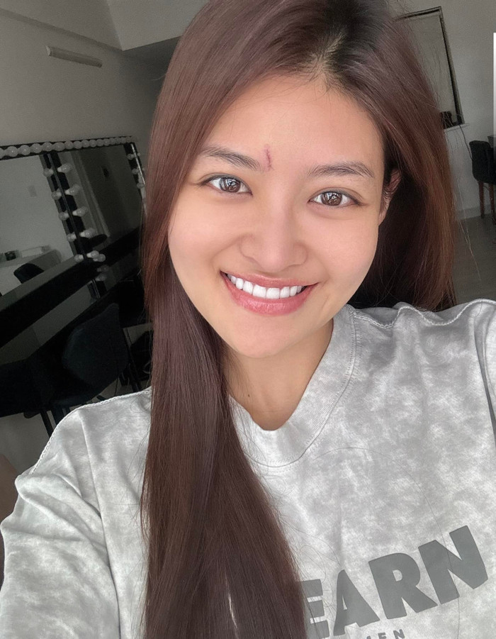 Hình ảnh mới nhất của diễn viên Thùy Anh. Ảnh: FBNV