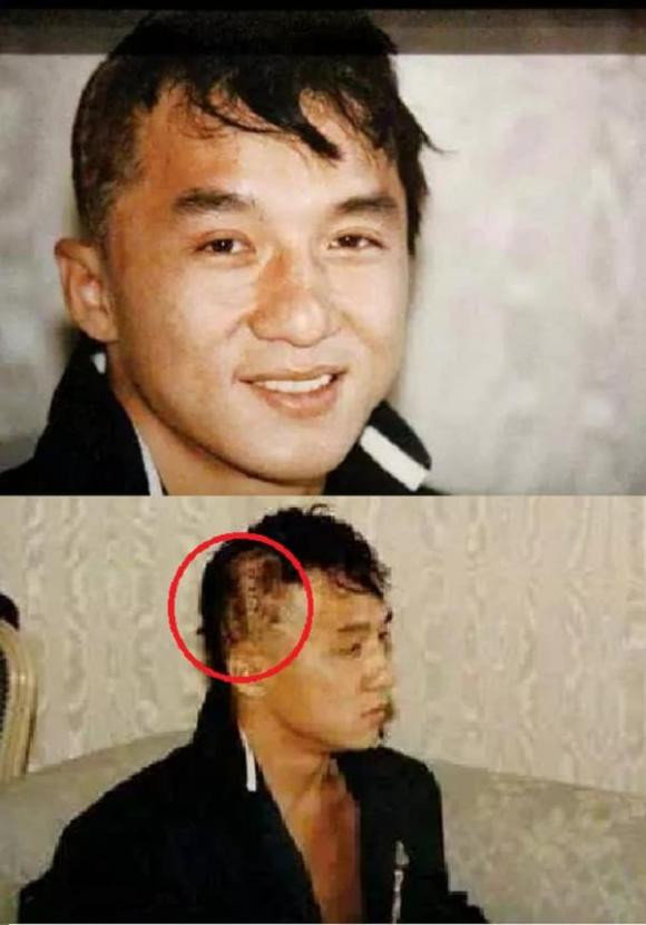 Thành Long từng cắt tóc ngắn, tự thực hiện cảnh quay nguy hiểm và gặp sự cố suýt mất mạng.