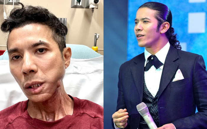 Kasim Hoàng Vũ: 'Đau không chịu nổi, mệt mỏi, run rẩy và yếu quá' Ảnh 2