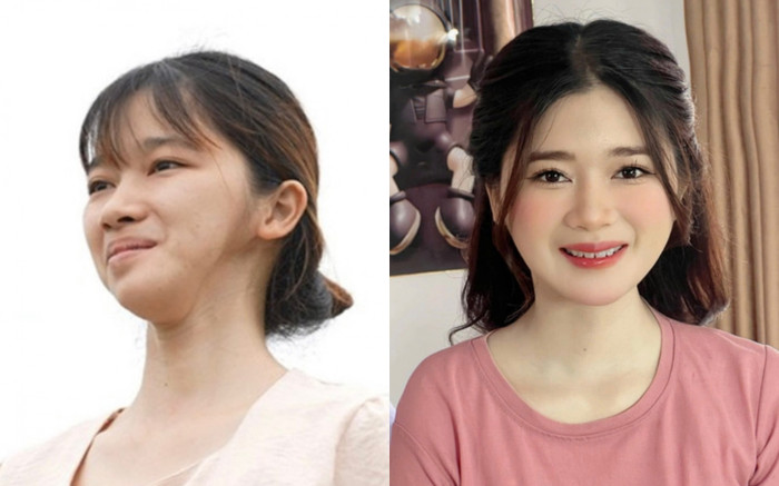 Từng bị bạn học bạo hành vì xấu xí, cô gái lột xác ngoạn mục khiến ai cũng bất ngờ Ảnh 2