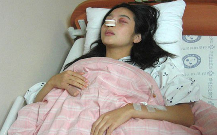 Nữ diễn viên ly dị sau 12 ngày kết hôn, bị chồng đánh đập tàn nhẫn Ảnh 2