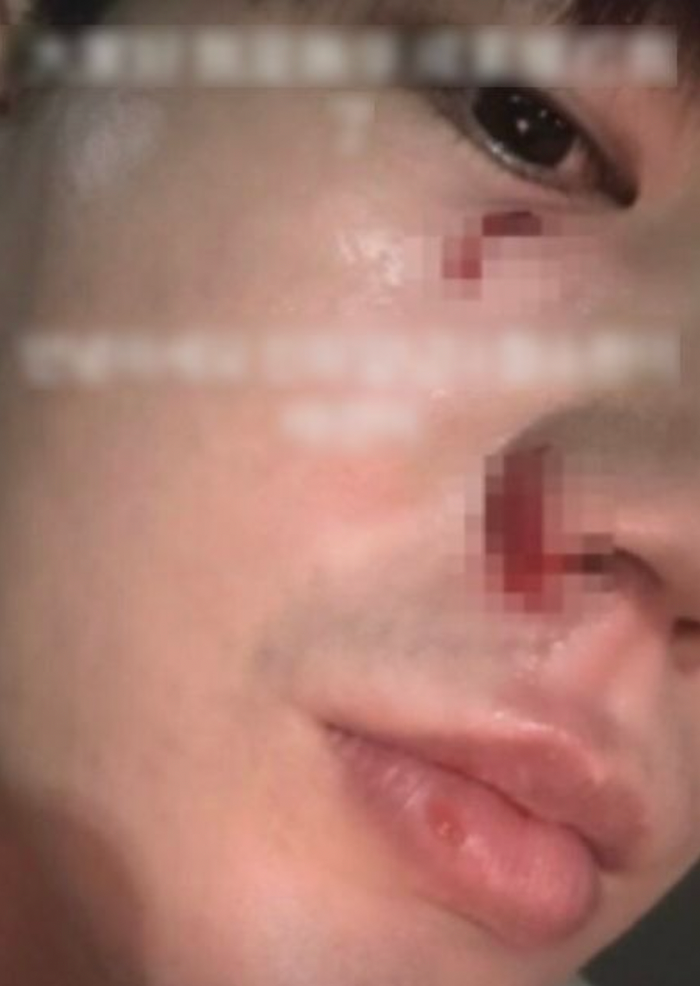 Trần Hoa từng tố Ham So Won bạo hành.