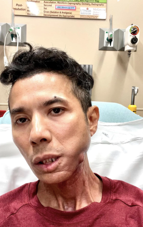 Hình ảnh Kasim Hoàng Vũ với vẻ ngoài tiều tuỵ, gầy rộc khiến nhiều người xót xa.