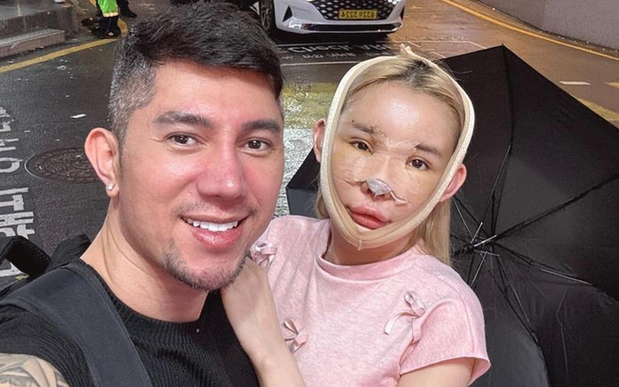 Vì sao Ngân 98 quyết định phẫu thuật thẩm mỹ nhiều lần? Ảnh 2