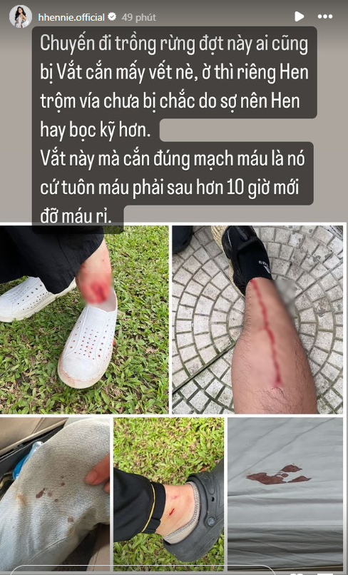Hoa hậu H'Hen Niê đăng tải loạt ảnh thương tích sau một chuyến đi trồng rừng. Ảnh chụp màn hình