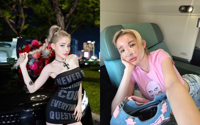 Trước khi can thiệp 'dao kéo' để giống Huyền Baby, Ngân 98 vốn có nhan sắc ưa nhìn sau nhiều lần phẫu thuật thẩm mỹ. Ảnh: FBNV