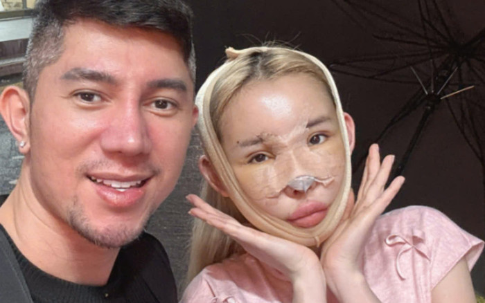 Ngân 98 đáp trả thế nào khi bị mỉa mai thẩm mỹ mũi hỏng Ảnh 2