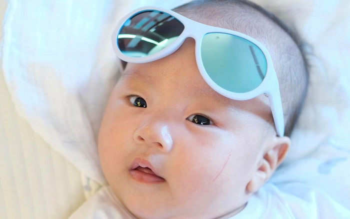 Con trai Phương Oanh bị vết rách dài ở mặt, Shark Bình lộ diện sau sự cố phải ngồi xe lăn Ảnh 2