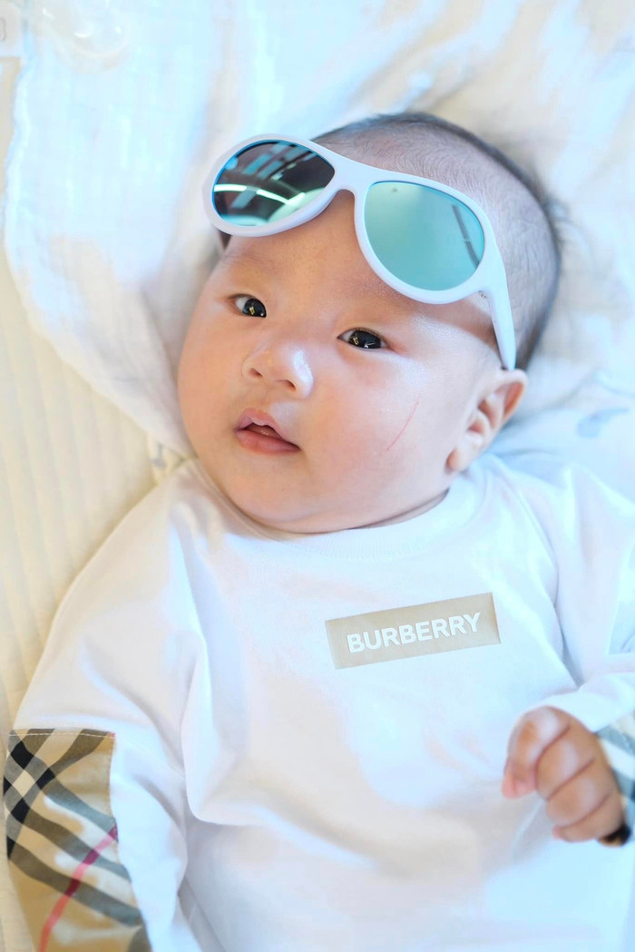 Bé Jimmy có vết rách dài trên mặt.