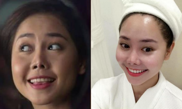 Phần mũi xiêu vẹo, cánh mũi không đều của diễn viên Tường Vi từng gây xôn xao nhiều năm về trước.