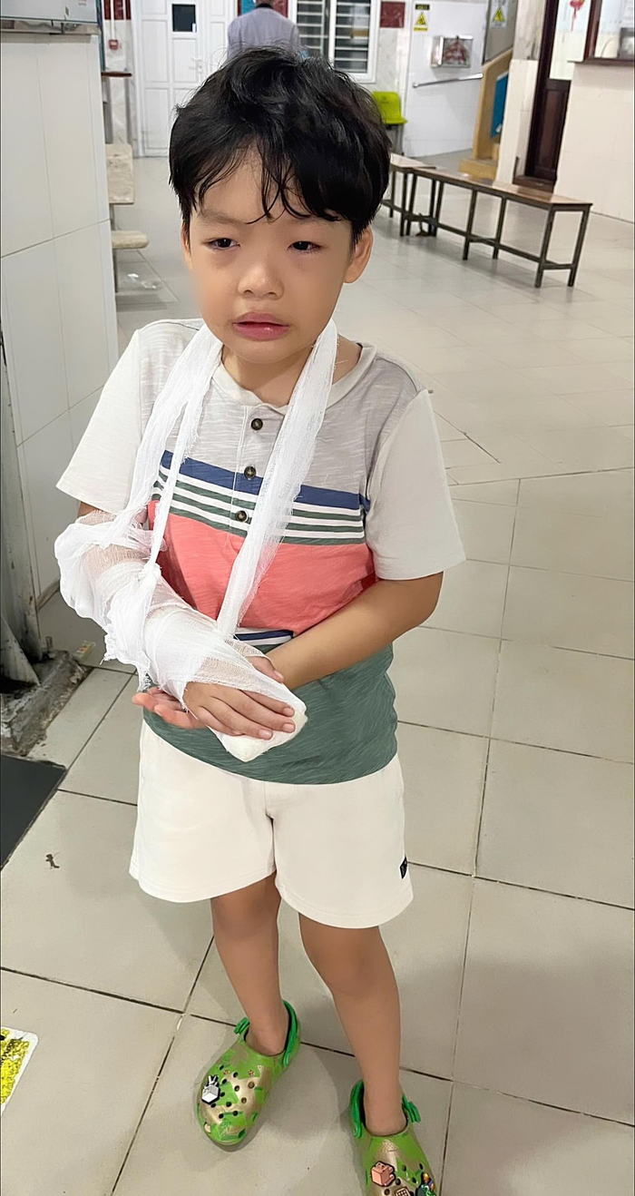 Dương Cẩm Lynh chia sẻ hình ảnh con trai bị té gãy tay, phải nhập viện băng bó.
