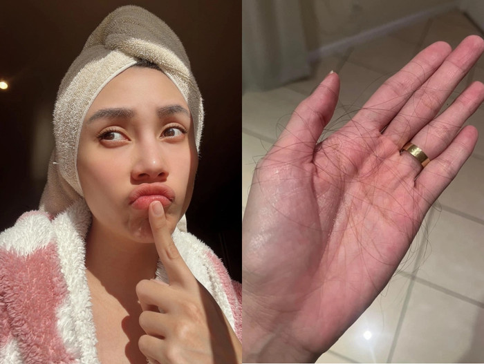 Võ Hoàng Yến từng cầu cứu dân mạng về tình trạng rụng tóc.