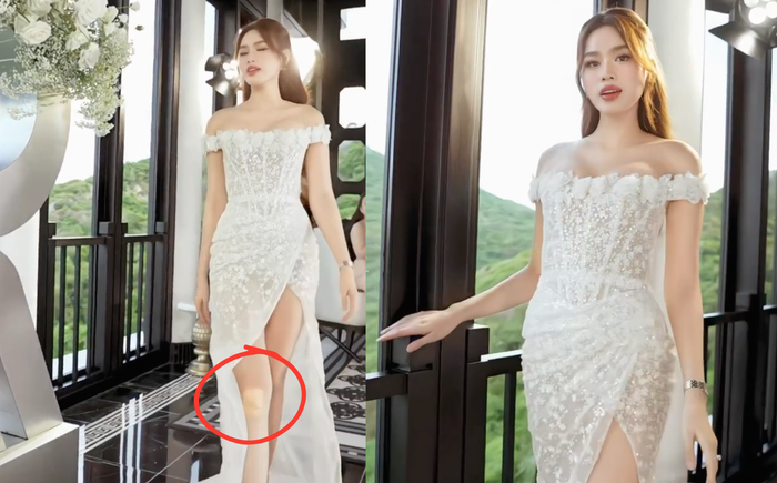 Đỗ Thị Hà băng vết thương ở đôi chân dài 1m11 khi diện váy xẻ cao đến tận hông.