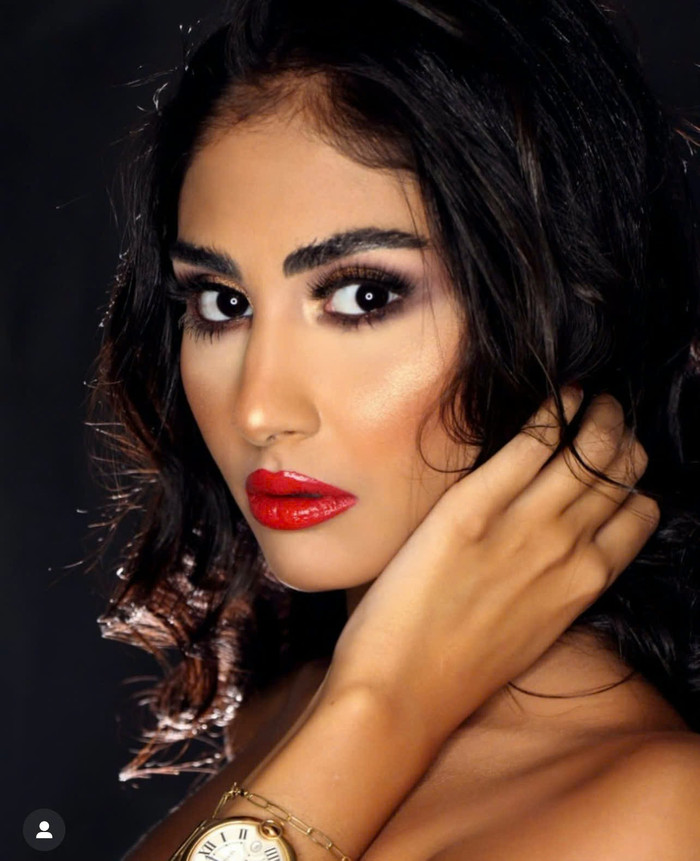 Người đẹp qua đời sau cơn đau tim.