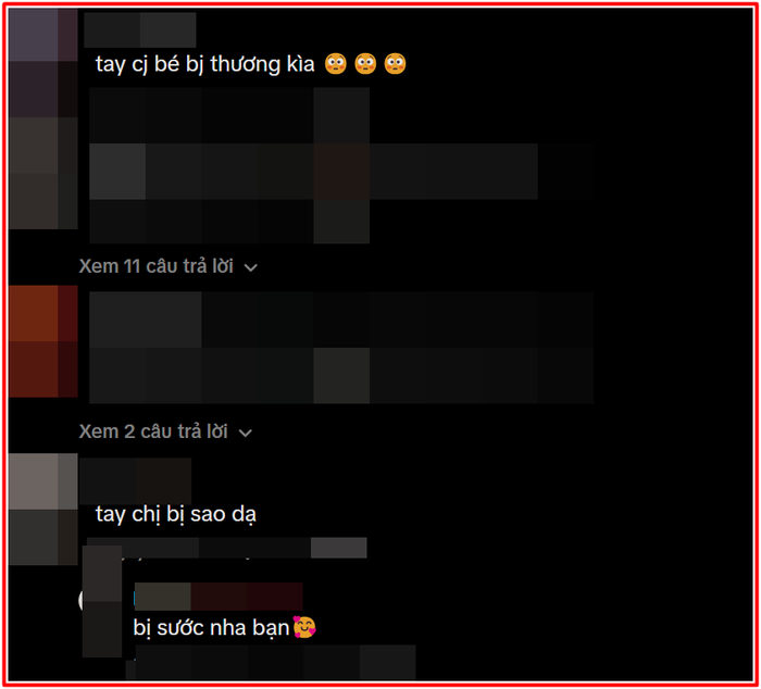 Nam Em gây lo lắng khi biểu diễn với vết sẹo trên tay Ảnh 4