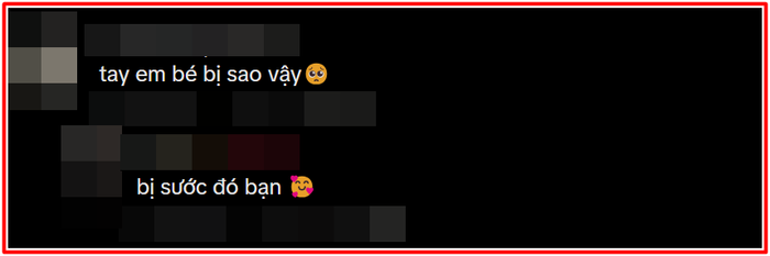 Nam Em gây lo lắng khi biểu diễn với vết sẹo trên tay Ảnh 2