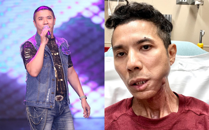 Kasim Hoàng Vũ vì sao vẫn chưa được mổ dù 10 ngày qua 'đau không chịu nổi, run rẩy và yếu quá'? Ảnh 2