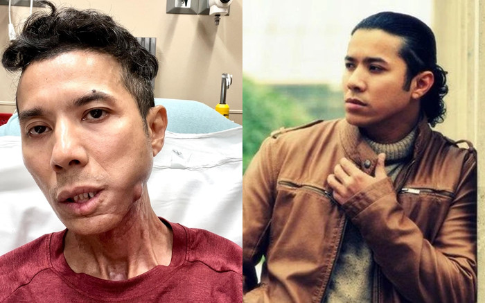 Chuyện gì xảy ra khiến Kasim Hoàng Vũ phải xin lỗi giữa lúc đau đớn, đêm nào cũng thức tới sáng? Ảnh 2