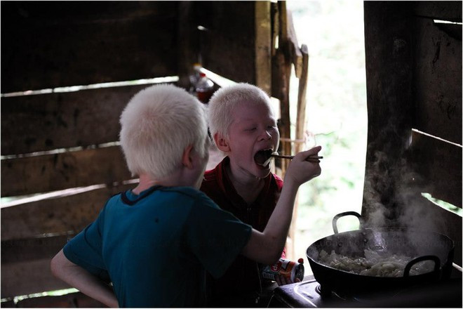 Bức ảnh của cặp song sinh từng gây sốt cộng đồng mạng