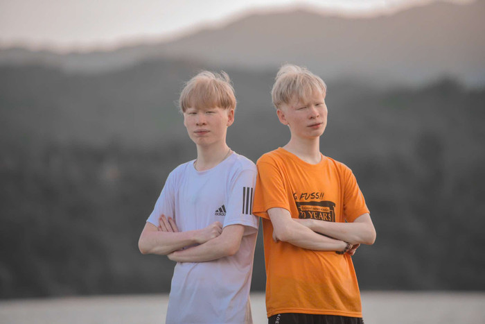 2 anh em từng có quá khứ tự ti và mặc cảm về ngoại hình