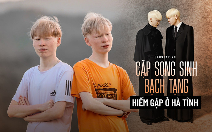 Cuộc sống kỳ lạ của cặp song sinh Hà Tĩnh có ngoại hình khác biệt, thu mình với thế giới bên ngoài Ảnh 2