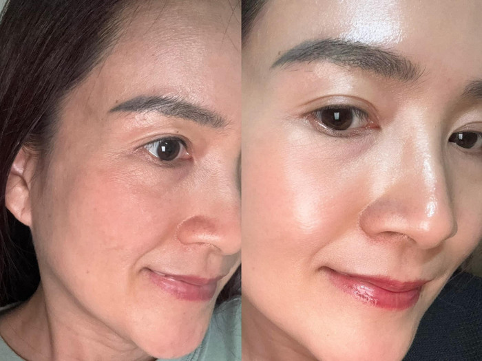 Làn da trước và sau 2 tuần sử dụng sản phẩm ứng dụng công nghệ Meso của vợ Bình Minh (ảnh FBNV).