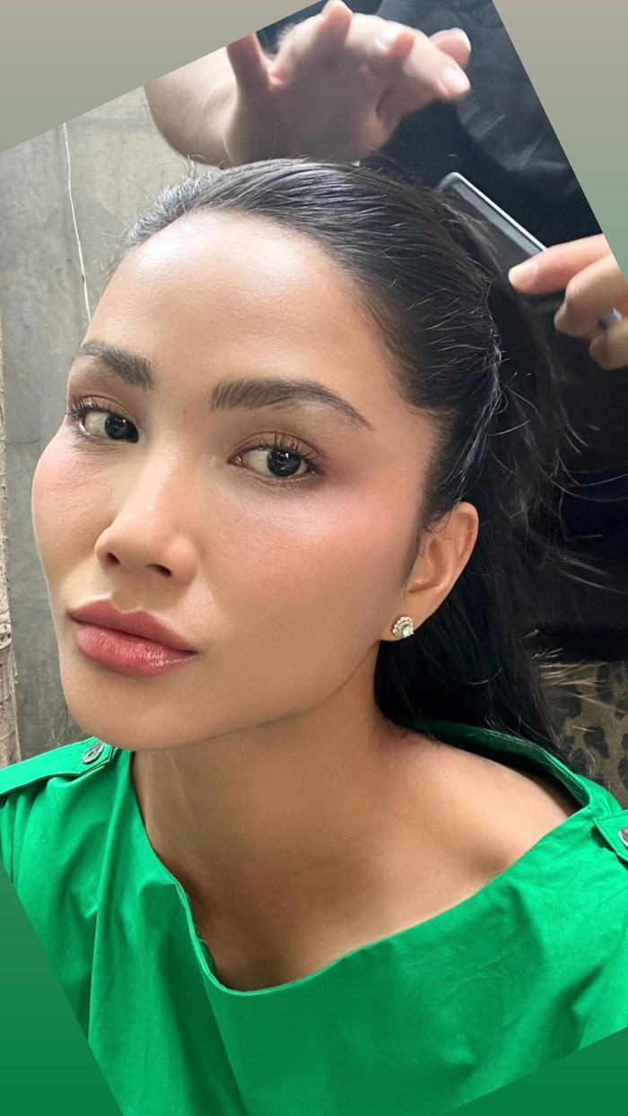 Hoa hậu H'Hen Niê bị kích ứng vì sử dụng mỹ phẩm giả do bạn trai mua nhầm. 