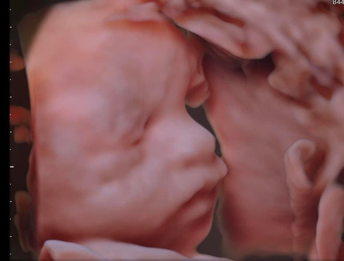 Trộm vía, sức khoẻ của mẹ và bé khoẻ mạnh.