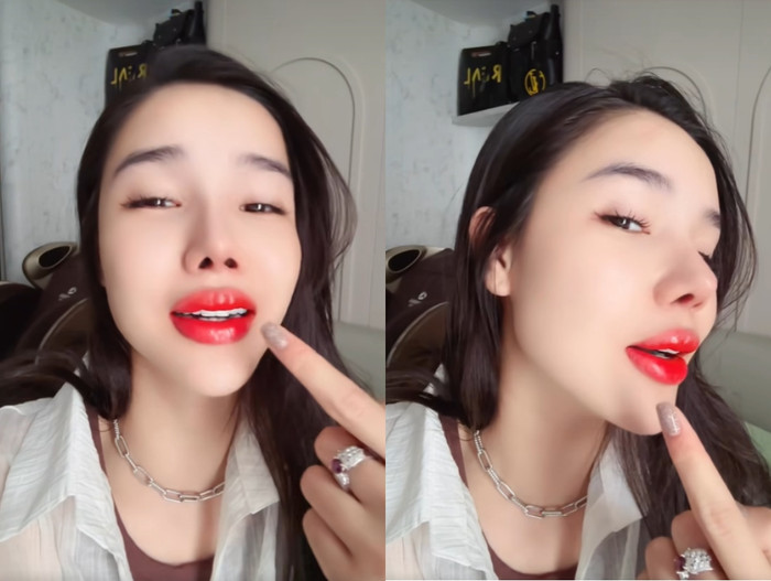 Vợ Mạc Hồng Quân chia sẻ về diện mạo sau thẩm mỹ. Ảnh chụp màn hình