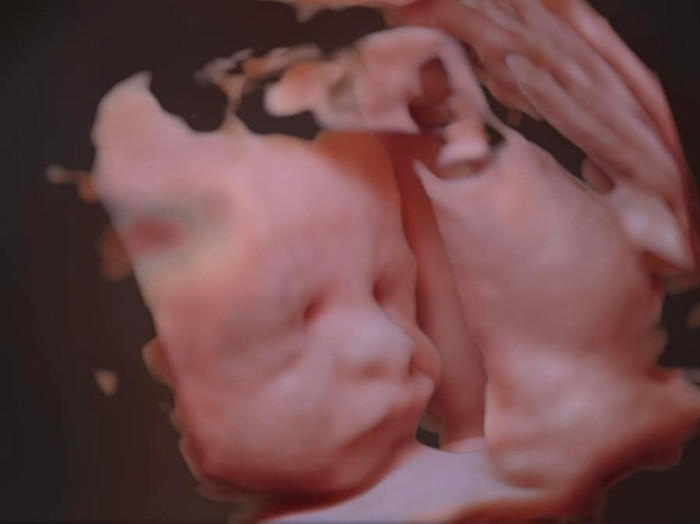 Ảnh phiếu siêu âm con trai Võ Hạ Trâm. Ảnh: FBNV