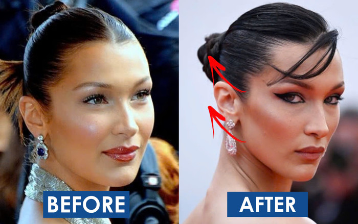 FaceTape: Căng cơ mặt bằng băng keo dính 'thống trị' giới làm đẹp TikTok Ảnh 2