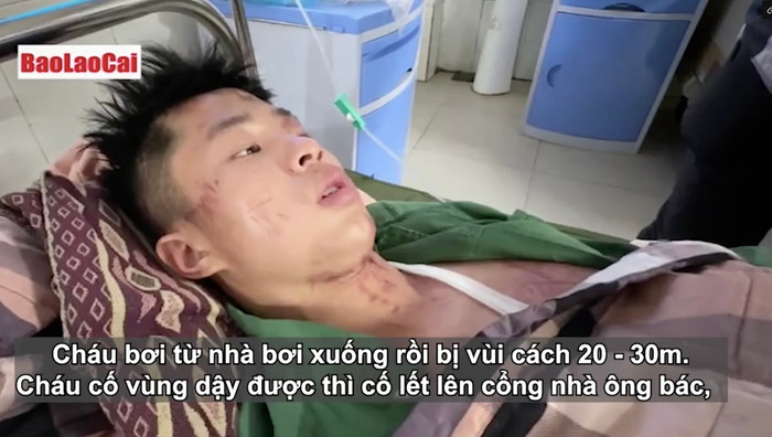 Anh Nguyễn Văn Hoàng, một trong những người may mắn thoát nạn. Ảnh Báo Lào Cai.