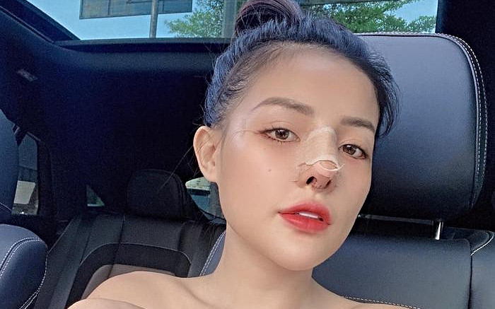 Ngân 98 bức xúc vì bị lợi dụng chuyện sửa mũi hỏng để quảng cáo Ảnh 2