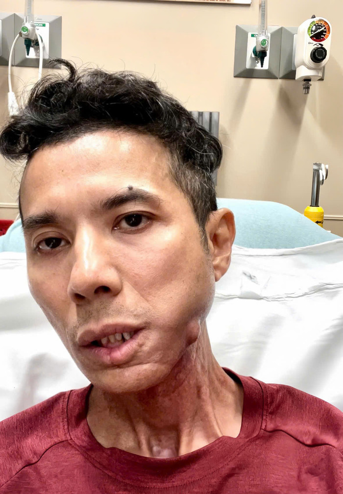 Nam diễn viên mới phải nhập viện cấp cứu.