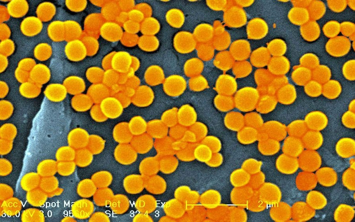 Cảnh báo siêu vi khuẩn chết người có thể kháng thuốc trị, Liên Hợp Quốc họp khẩn Ảnh 2