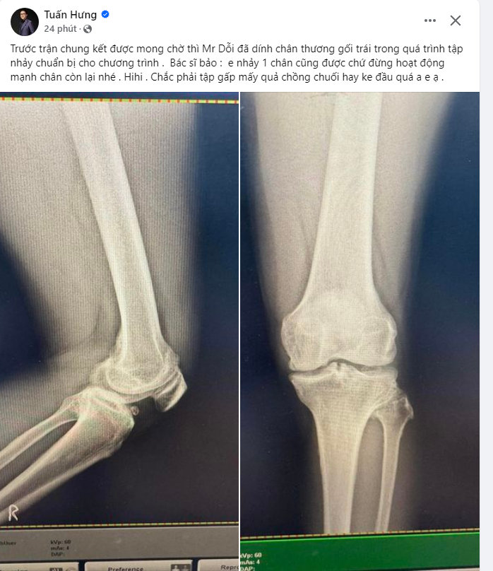 Bài đăng thông báo tình hình sức khoẻ mới nhất của Tuấn Hưng. 