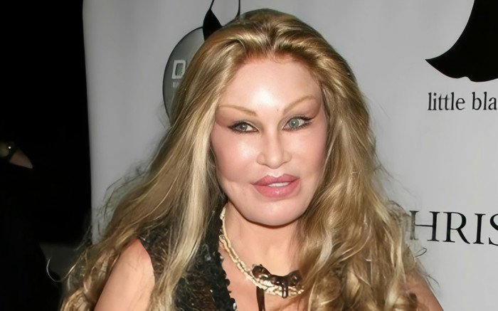 Nữ tỷ phú nghiện phẫu thuật khuôn mặt giống mèo, nay ra sao khi xài hết 61 nghìn tỷ? Ảnh 2