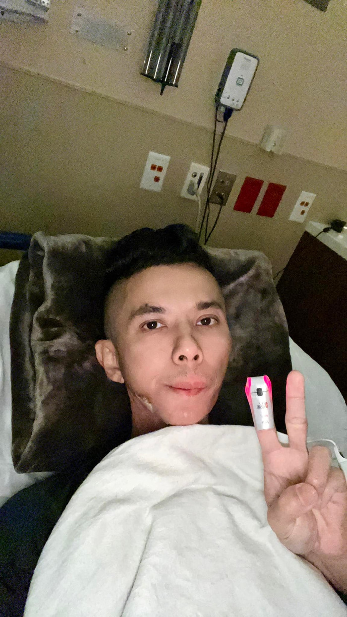 Nam ca sĩ phải mổ lần 2 vì căn bệnh viêm khớp xương hàm. 