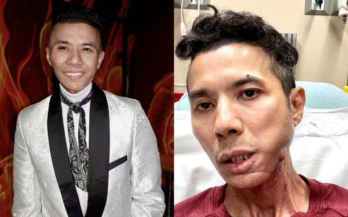 Nữ diễn viên khóc nghẹn khi thấy Kasim Hoàng Vũ gặp bạo bệnh, tặng phong bì nghìn đô Ảnh 2