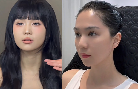Ngọc Trinh khoe gương mặt căng mịn sau khi sử dụng hai phương pháp trên.