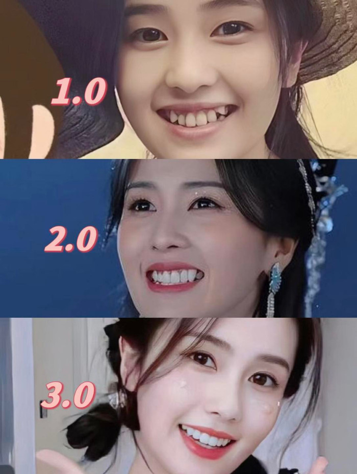 Bạch Lộc đã nhiều lần chỉnh sửa để có được hàm răng đẹp như hiện tại. 