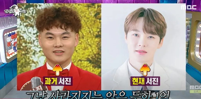 Nam ca sĩ chi gần 2 tỷ phẫu thuật gương mặt, trở thành người hoàn toàn khác Ảnh 1