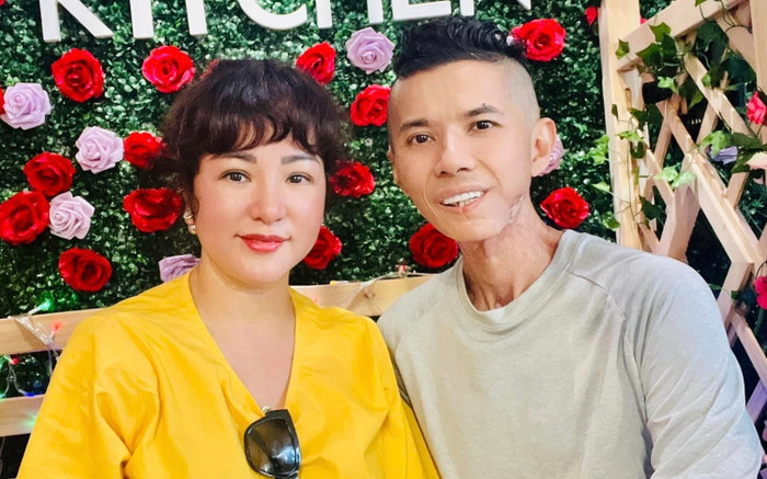 Kasim Hoàng Vũ trước khi mổ vẫn gượng đau gặp đồng nghiệp, thể trạng hiện tại gây chạnh lòng Ảnh 2