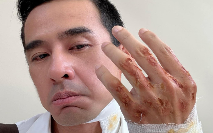 Lương Thế Thành người đầy thương tích Ảnh 2