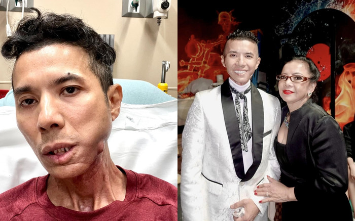 Nữ diễn viên tiết lộ chi phí Kasim Hoàng Vũ phải bỏ ra để mổ lần 2, ngậm ngùi 'tốn kém lắm' Ảnh 2