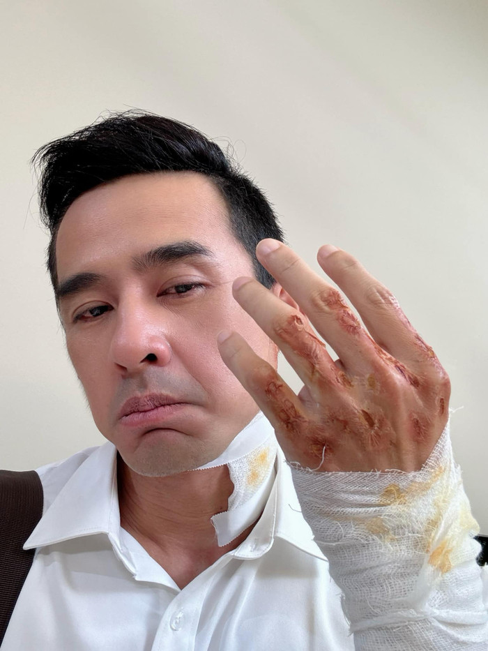 Showbiz 21/9: Hình ảnh này của Lương Thế Thành khiến nhiều khán giả lo lắng. Ảnh: FBNV