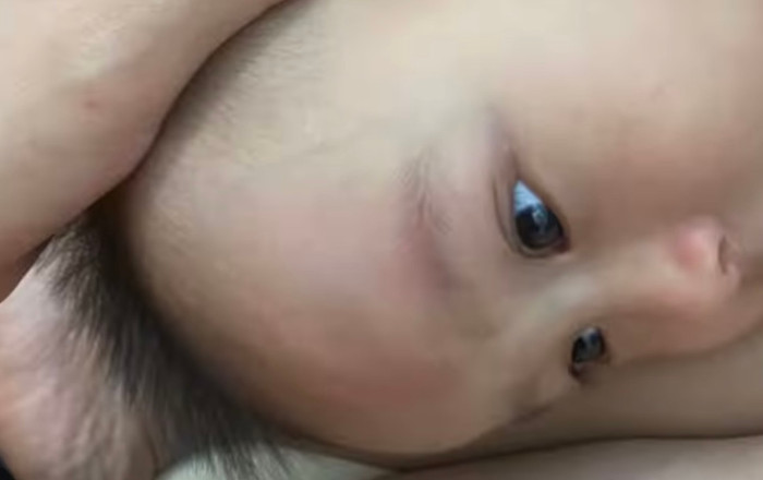 May mắn, em bé chỉ bị vết thương ngoài da, thế nhưng tình huống này là một lời cảnh báo cho các bà mẹ trong việc chăm sóc con nhỏ.