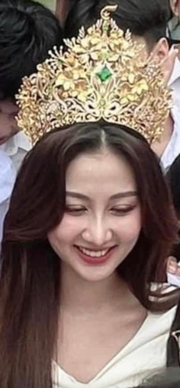 Hoa hậu Quế Anh được cho đã thẩm mỹ phần mắt, mũi và cằm.